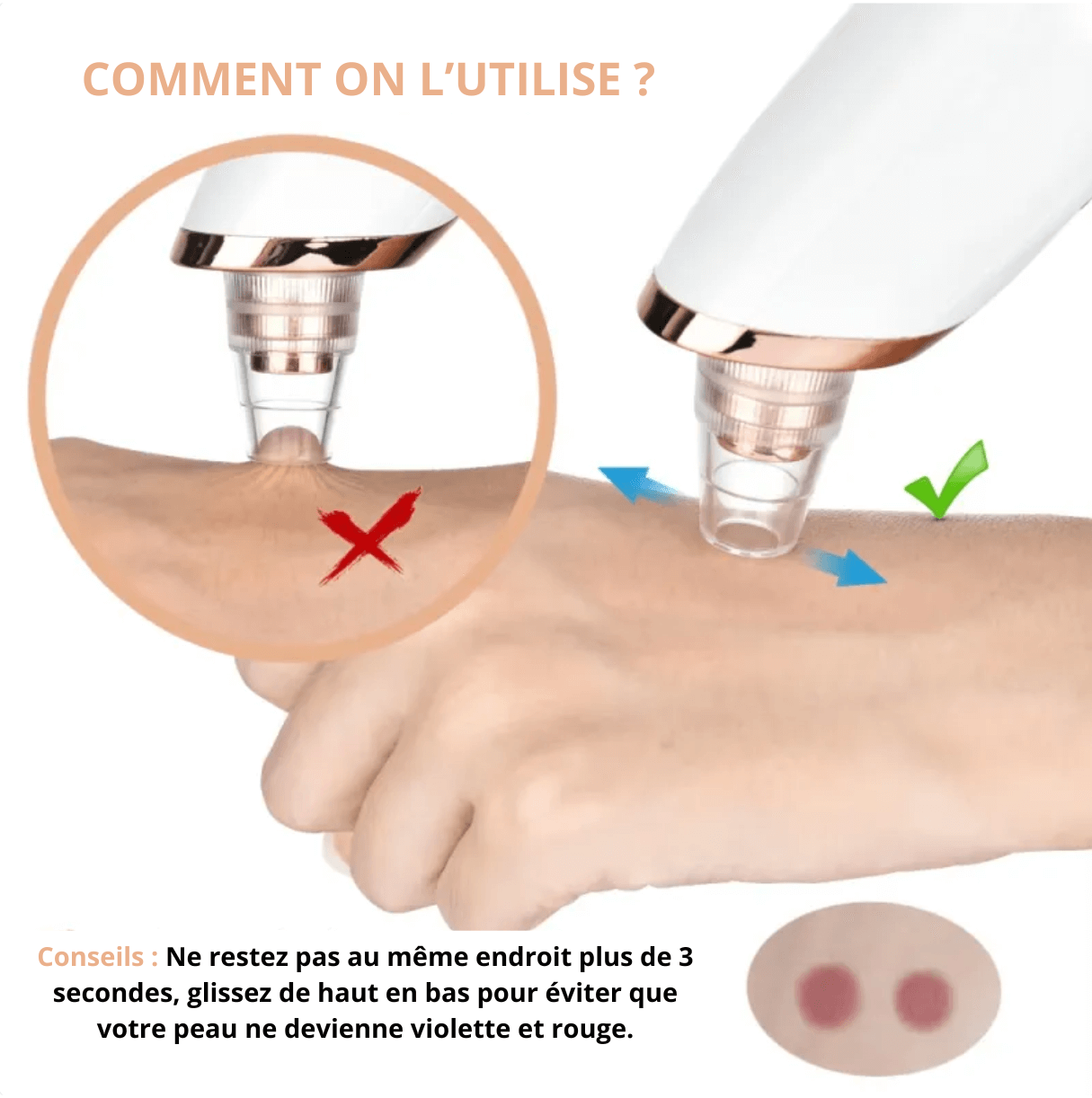 Aspirateur Points Noirs PureSkinSecrets™
