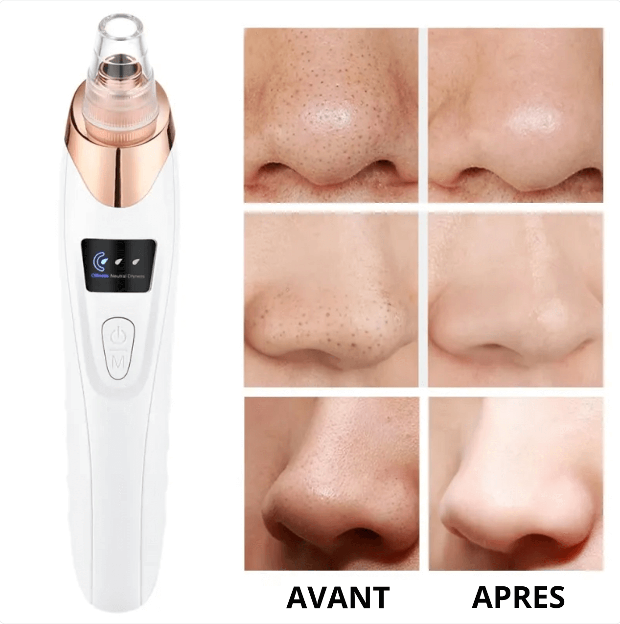 Aspirateur Points Noirs PureSkinSecrets™