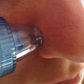 Aspirateur Points Noirs PureSkinSecrets™